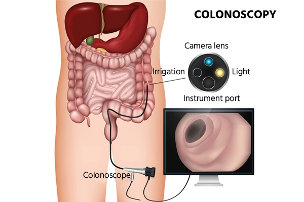 Video Colonoscopy Suite Parasmoni Medicare Bankura