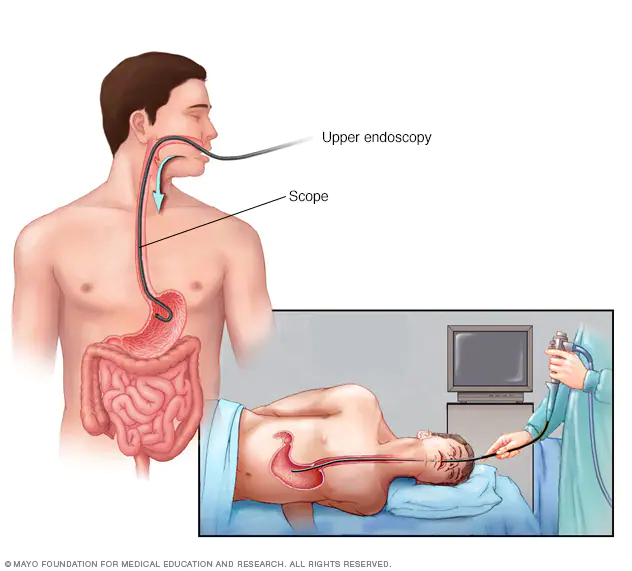 Upper GI Photo Endoscopy Suite Parasmoni Medicare Bankura